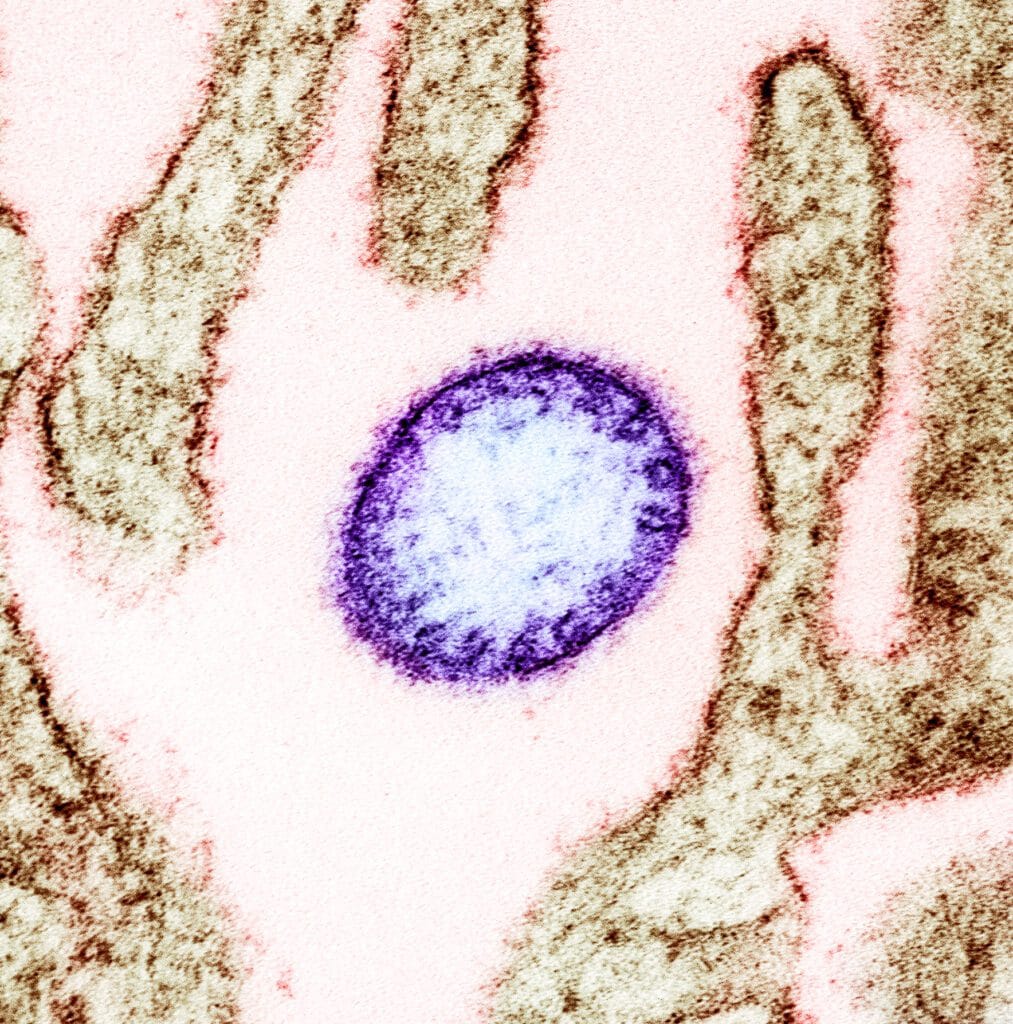 The Deadly Nipah Virus Is Sparking Global Concern — But The Philippines Says It’s Not Sweating It DOH: Philippines prepared for Nipah virus following regional alerts