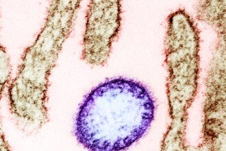 DOH: Philippines prepared for Nipah virus following regional alerts